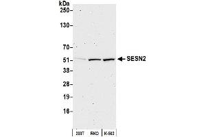 anti-Sestrin 2 (SESN2) (AA 275-325) antibody