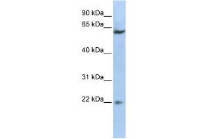 WB Suggested Anti-SUFU Antibody Titration:  0. (SUFUH 抗体  (Middle Region))