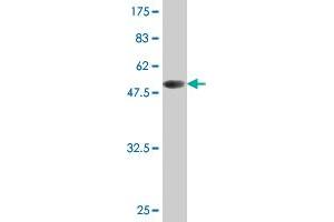Western Blot detection against Immunogen (51. (TK1 抗体  (AA 1-234))