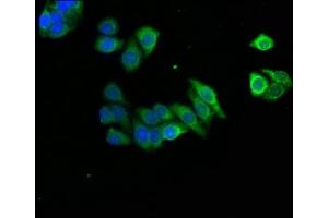 Immunofluorescence staining of HepG2 cells with ABIN7143681 at 1:166, counter-stained with DAPI. (AOX1 抗体  (AA 236-421))