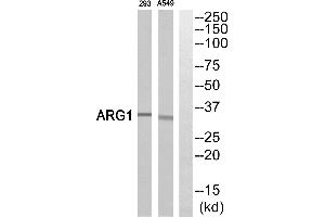Western blot analysis of extracts from 293 cells and A549 cells, using ARG1antibody. (Liver Arginase 抗体)