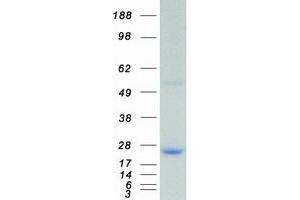 Validation with Western Blot (Dual Specificity Phosphatase 3 (DUSP3) protein (Myc-DYKDDDDK Tag))