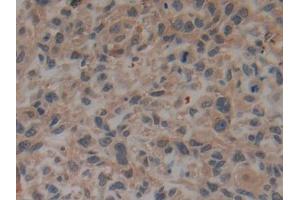 Immunohistochemistry (IHC) image for anti-Plasminogen Activator, Tissue (PLAT) (AA 311-562) antibody (ABIN1860843)