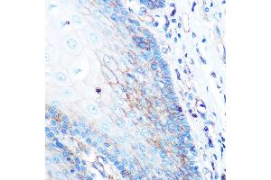 Immunohistochemistry of paraffin-embedded human esophageal using HLA-A Rabbit mAb (ABIN7268366) at dilution of 1:100 (40x lens). (HLA-A 抗体)