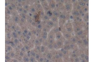 Detection of MMP3 in Rat Liver Tissue using Monoclonal Antibody to Matrix Metalloproteinase 3 (MMP3) (MMP3 抗体  (AA 278-450))