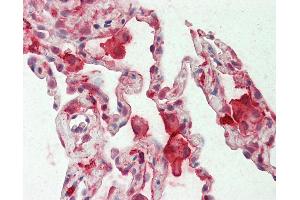 Anti-CAPG / MCP antibody IHC staining of human lung. (CAPG 抗体  (AA 205-217))