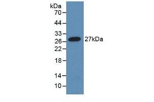 Detection of Recombinant ANGPTL1, Human using Monoclonal Antibody to Angiopoietin-3 (ANG-3) (Angiopoietin 4 抗体  (AA 271-491))
