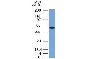 Western Blot Analysis of MCF-7 cell lysate with Occludin Mouse Monoclonal Antibody (OCLN/2181). (Occludin 抗体  (AA 282-415))