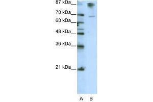 Western Blot showing HKR1 antibody used at a concentration of 1-2 ug/ml to detect its target protein. (HKR1 抗体  (C-Term))