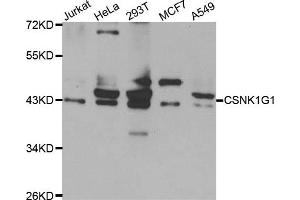 Western blot analysis of extracts of various cell lines, using CSNK1G1 antibody. (CSNK1G1 抗体)