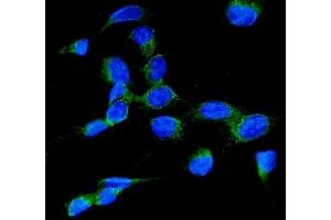 IF analysis of RAB7 using anti-RAB7 antibody (ABIN3044538). (RAB7A 抗体  (C-Term))