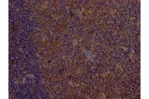 IHC image of ABIN7127410 diluted at 1:100 and staining in paraffin-embedded human tonsil tissue performed on a Leica BondTM system. (Recombinant CD8 抗体)