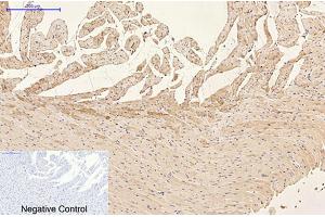 Immunohistochemical analysis of paraffin-embedded rat heart tissue. (GFAP 抗体)