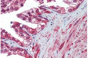 Prostate, Human: Formalin-Fixed, Paraffin-Embedded (FFPE) (Calnexin 抗体)