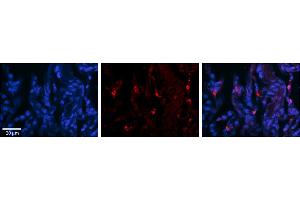 Immunohistochemistry (IHC) image for anti-DEAH (Asp-Glu-Ala-His) Box Polypeptide 30 (DHX30) (N-Term) antibody (ABIN2775264)