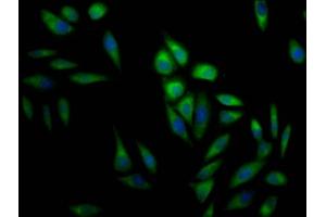 Immunofluorescence staining of Hela Cells with ABIN7127477 at 1:50, counter-stained with DAPI. (Recombinant ERK2 抗体)