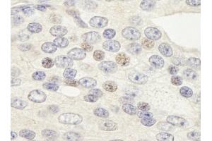 Immunohistochemistry (IHC) image for anti-Zinc Finger Protein 592 (ZNF592) (AA 950-1000) antibody (ABIN7448883)