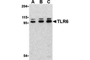 Western Blotting (WB) image for anti-Toll-Like Receptor 6 (TLR6) (Middle Region) antibody (ABIN1031130) (TLR6 抗体  (Middle Region))