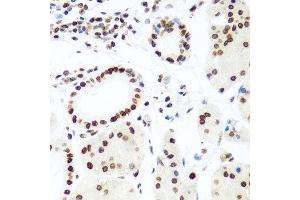 Immunohistochemistry of paraffin-embedded human gastric using H2AFX antibody at dilution of 1:100 (x40 lens). (H2AFX 抗体)