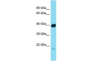 Western Blotting (WB) image for anti-Regulator of Chromosome Condensation (RCC1) and BTB (POZ) Domain Containing Protein 1 (RCBTB1) (N-Term) antibody (ABIN2790441) (RCBTB1 抗体  (N-Term))