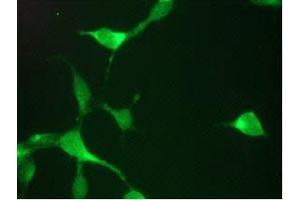Immunofluorescent staining of LNCaP cells