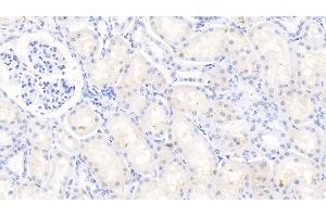 Detection of MMP3 in Bovine Kidney Tissue using Polyclonal Antibody to Matrix Metalloproteinase 3 (MMP3) (MMP3 抗体  (AA 18-477))