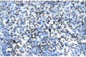 Human Spleen; CLDN17 antibody - middle region in Human Spleen cells using Immunohistochemistry (Claudin 17 抗体  (Middle Region))