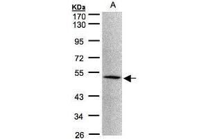 WB Image Sample(30 μg of whole cell lysate) A:293T 10% SDS PAGE antibody diluted at 1:1000 (MOK 抗体)