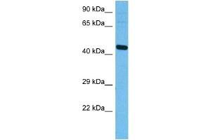 Host:  Rabbit  Target Name:  ATF4  Sample Tissue:  Mouse Brain  Antibody Dilution:  1ug/ml (ATF4 抗体  (N-Term))