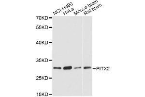 Western blot analysis of extracts of various cell lines, using PITX2 antibody (ABIN5975338) at 1:3000 dilution. (PITX2 抗体)