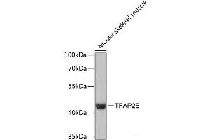 Western blot analysis of extracts of Mouse skeletal muscle using TFAP2B Polyclonal Antibody at dilution of 1:3000.