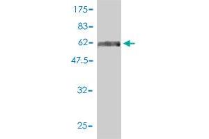 Western Blot detection against Immunogen (71. (TUBA3C 抗体  (AA 1-418))