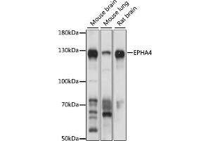 Western blot analysis of extracts of various cell lines, using EPH antibody (ABIN6132064, ABIN6140215, ABIN6140216 and ABIN6224369) at 1:1000 dilution. (EPH Receptor A4 抗体  (AA 887-986))