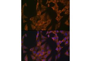 Immunofluorescence analysis of NIH-3T3 cells using Zyxin Rabbit mAb (ABIN1682627, ABIN3015962, ABIN3015963 and ABIN7101467) at dilution of 1:100 (40x lens). (ZYX 抗体)