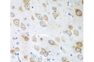 Immunohistochemistry (Paraffin-embedded Sections) (IHC (p)) image for anti-G-Elongation Factor, Mitochondrial 1 (GFM1) antibody (ABIN7261181)