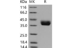 Western Blotting (WB) image for Cell Adhesion Molecule 3 (CADM3) protein (His tag) (ABIN7320264)