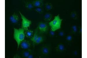 Anti-BUB1B mouse monoclonal antibody (ABIN2452850) immunofluorescent staining of COS7 cells transiently transfected by pCMV6-ENTRY BUB1B (RC205844). (BUB1B 抗体)