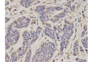 Immunohistochemistry (IHC) image for anti-Proteasome (Prosome, Macropain) 26S Subunit, ATPase, 4 (PSMC4) antibody (ABIN1874384) (PSMC4 抗体)
