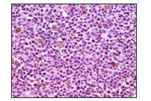 Immunohistochemical analysis of paraffin-embedded human lymphnode tissues using MCL1 mouse mAb with DAB staining. (MCL-1 抗体)