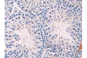 Detection of AHSG in Mouse Testis Tissue using Polyclonal Antibody to Alpha-2-Heremans Schmid Glycoprotein (AHSG)