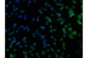 Immunofluorescence staining of Jurkat cells with ABIN7148445 at 1:166, counter-stained with DAPI. (CNKSR2 抗体  (AA 650-800))