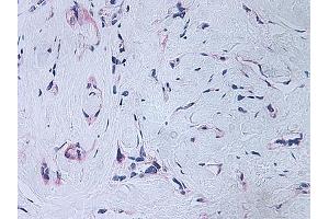 Image no. 2 for anti-Platelet Factor 4 (PF4) antibody (ABIN465152) (PF4 抗体)