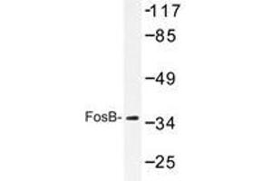 Western blot analyzes of FosB antibody in extracts from COS7 cells.