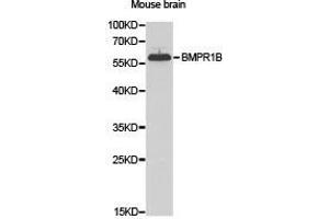 Western Blotting (WB) image for anti-Bone Morphogenetic Protein Receptor, Type IB (BMPR1B) antibody (ABIN1871327) (BMPR1B 抗体)