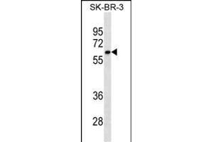 CYP1A2 Antibody ABIN1539921 western blot analysis in SK-BR-3 cell line lysates (35 μg/lane). (CYP1A2 抗体  (AA 255-282))
