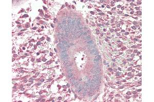 Human Uterus: Formalin-Fixed, Paraffin-Embedded (FFPE).