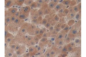 IHC-P analysis of Human Liver Tissue, with DAB staining. (LCAT 抗体  (AA 41-210))