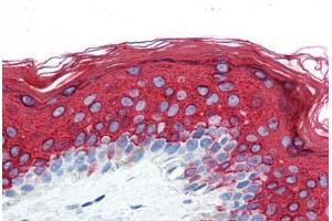 Human Skin (formalin-fixed, paraffin-embedded) stained with KRT10 antibody ABIN364279 at 10 ug/ml followed by biotinylated anti-mouse IgG secondary antibody ABIN481714, alkaline phosphatase-streptavidin and chromogen. (Keratin 10 抗体)