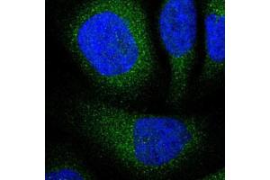 Immunofluorescent staining of U-2 OS with UBE2I polyclonal antibody  (Green) shows positivity in cytoplasm.