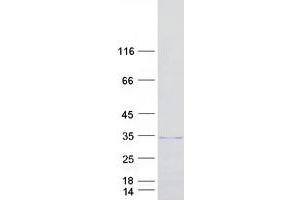 Western Blotting (WB) image for Leucine Rich Repeat Containing 18 (LRRC18) protein (Myc-DYKDDDDK Tag) (ABIN2724897)
